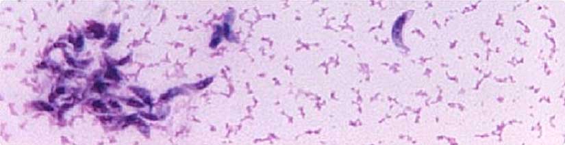 Toxoplasma gondii parasites